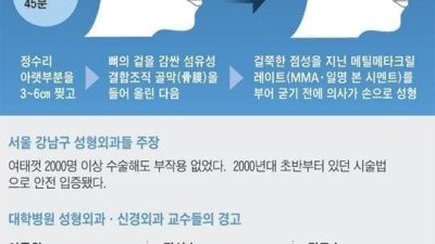무시무시한 요즘 성형수술