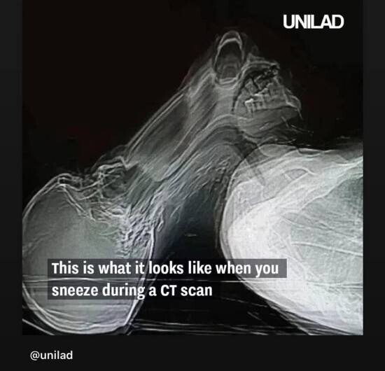 093d452cda58b34d739811d414a3eacb_1694788773_778.jpg